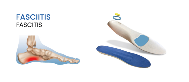 Flexor Soft Care Fasciitis