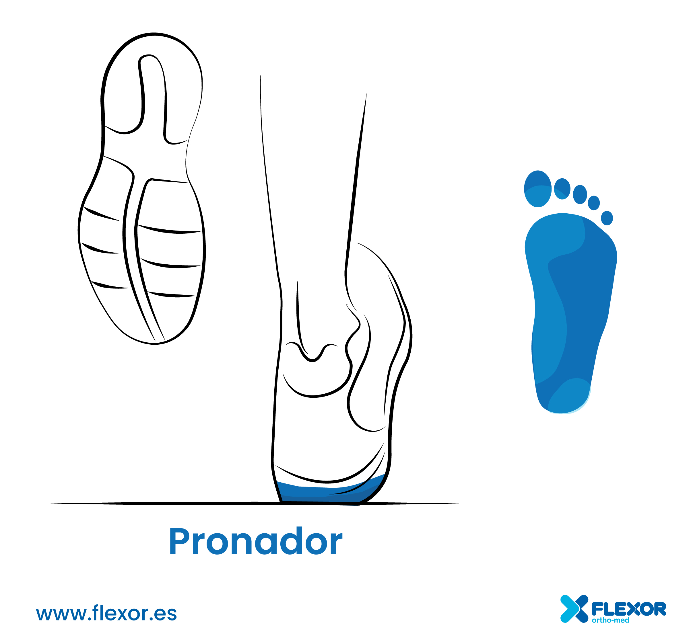 PRONADOR_1_flexor